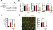 DAPK3 knockdown increases the expression of metabolism-associated genes thr...