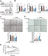DAPK3 regulates IR-induced cellular senescence via a protein kinase B (AKT)...