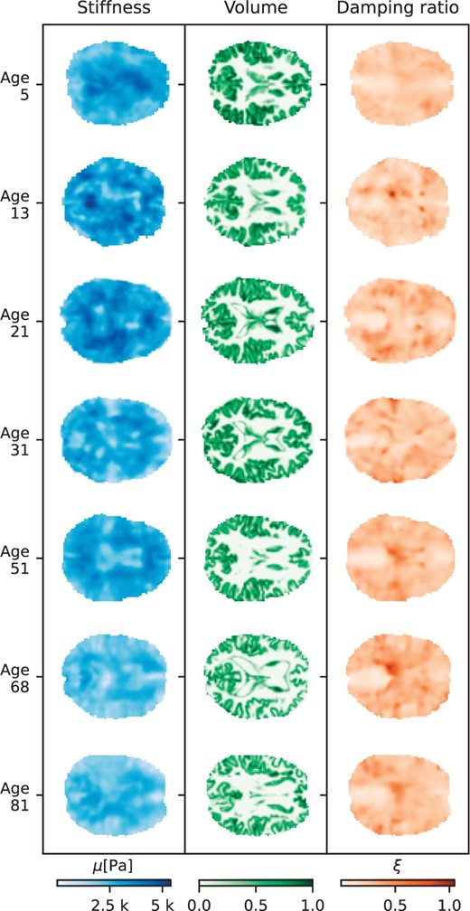 Stiffness, damping ratio, and volume map slices (axial with z=28) for cognitively normal subjects of different ages. Stiffness measurements (left) and volume measurements (middle) show decreases in the older subjects.