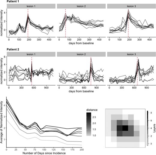 Top 2 rows: lesion trajectories over time for three lesions randomly selected from two participants in the study. Here, 10 voxels are randomly chosen from each lesion to illustrate the intensity trajectories of the lesion voxels (in black) during the full course of the study. The red dotted line shows the lesion incidence time for each lesion within the full study duration for each of the two participants. Bottom row: intensity trajectories averaged across each lesion layer and colored by the distance of that layer from the lesion boundary (left). These trajectories correspond to the lesion presented on the right. A 2D slice from a lesion where each voxel is colored by its distance to lesion boundary (right). Layer 0 does not contain lesion voxels.
