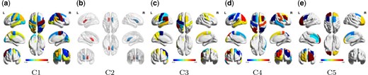 The brain map of the five identified components in the ADNI analysis. (a), (c), (d), and (e) primarily show the cortical regions; (b) shows two subcortical regions, the left and right caudate nucleus.