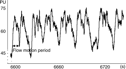 Extracts of 120 s of ileal MBF tracing by LDF in arbitrary PU. Note the absence of respiratory oscillations and peristaltic artifacts. Flow motion oscillations are present with frequency of 4–6 min−1.