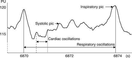 Extracts of hepatic MBF tracing by LDF in arbitrary PU. Respiratory oscillations are regular and constant throughout the experiment and slightly alter the signal amplitude.