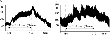 Extracts of typical (a) hepatic and (b) ileal MBF tracing by LDF in arbitrary PU. Relative MBF changes before, during continuous infusion of SNP, and after discontinuing drug administration. MBF increases during SNP administration and decreases after discontinuation.