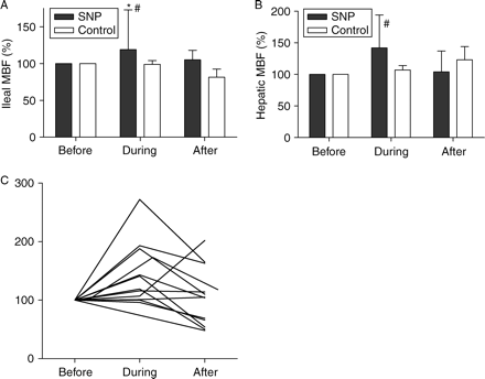 Relative (a) ileal and (b) hepatic MBF changes during drug administration. Endotoxic pigs were resuscitated with either SNP or NS (control). Relative changes before, during continuous infusion, and 30 min after discontinuing administration of the test drug. All MBFs were set at 100% before administration of the test drug. MBFs were expressed as percentage of their values before drug administration. (c) Individual ileal MBF during SNP infusion. *P<0.05 (significant difference between values, before and after drug administration); #P<0.05 (significant difference from control).