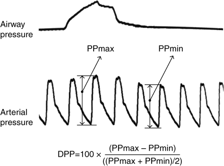 Illustration of the DPP measurement. First line represents the upper airway pressure and the second line represents the invasive arterial pressure. DPP, delta pulse pressure; PP, pulse pressure. Equation is explained in the text.