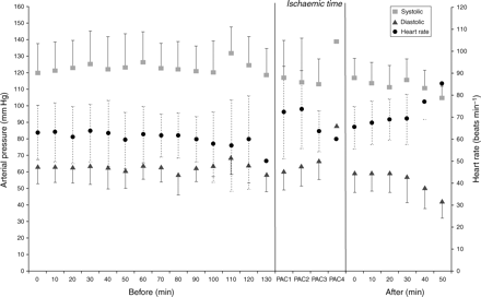 Mean arterial pressure and heart rate throughout surgery, values displayed every 10 min and the lowest of each variable during each ischaemic time during OPCAB.