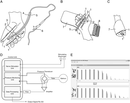 (a) The CMG quantifies the pressure changes in a hand-held balloon as a measure of the force created by the hand contraction. 1, two plastic strips; 2, aperture for air delivery to the balloon; 3, balloon; 4, inner tubing for air delivery to the balloon; 5, outer rigid tubing to hold the balloon in place; 6, three-way valve connector for air delivery to the balloon. (b) The CMG monitor’s hand strap. 7, hand strap; 8, hook and loop fastener strap. (c) The CMG monitor after closing the fastener strap. (d) CMG architecture and hardware connections. (e) Displayed TOF of the CMG and MMG.