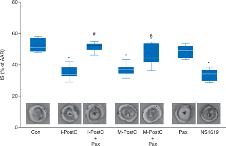Infarct size data. Histogram shows the infarct size (% of area at risk, AAR) of controls (Con), ischaemic post-conditioning (I-PostC), ischaemic post-conditioning and paxilline (I-PostC+Pax), morphine post-conditioning (M-PostC), morphine post-conditioning and paxilline (M-PostC+Pax), paxilline alone (Pax), and NS1619. The boxes represent the lower (25th) and upper (75th) quartiles, the horizontal line represents the mean, the whiskers extend to 95% confidence intervals for the mean, *P<0.05 vs Con, #P<0.05 vs I-PostC, and §P<0.05 vs M-PostC.
