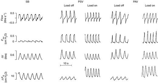 patient ventilator interaction bja british journal of anaesthesia