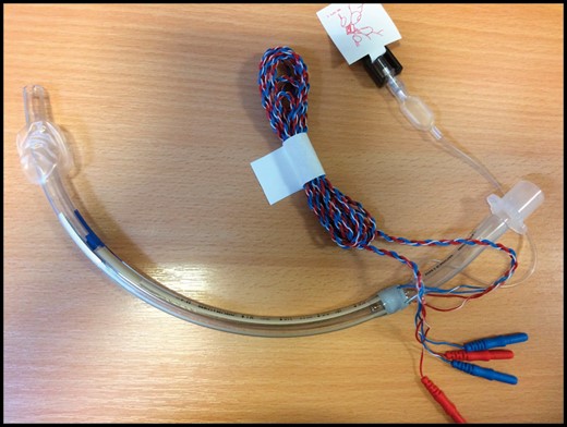 Neural integrity monitor tubes with embedded electrodes for intralaryngeal electromyography.