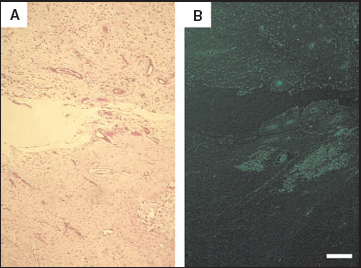 Formation of granulation tissue in green fluorescent protein (GFP)‐transgenic rats. A biopsy was taken from the tissue‐transplanted rats (Fig. 1) at 2 weeks. Granulation tissue had formed in all wounds transplanted with dermis, adipose tissue, skeletal muscle, peripheral blood cells or bone marrow cells (A, haematoxylin and eosin staining). GFP‐positive granulation tissue, examined under excitation at 489 nm, formed only in wounds treated with bone marrow cells derived from GFP‐transgenic rats (B) and to a much lesser degree in those treated with buffy coat. GFP‐positive granulation tissue did not form in wounds treated with dermis derived from GFP‐transgenic rats. Scale bar = 80 µm (A,B).