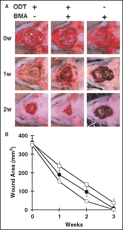 Wound contraction studies in rats. An oval area (2 × 3 cm) was surgically excised down to the muscle fascia, then an oval area (1 × 2 cm) was further excised down to the calvarium bone. Three types of treatments were performed to treat eight wounds with exposed bones (n = 24 animals in total) (A). The results were photographed every week, followed by planimetry using NIH image software. Two weeks after the operation, deep wounds treated with bone marrow cells plus an occlusive dressing had healed significantly more rapidly (B) than those treated either with the occlusive dressing only (P < 0·0001) or with the topical administration of bone marrow cells plus a semidry to dry dressing (P < 0·0001). ODT, Occlusive dressing therapy; BMA, bone marrow administration; ○, ODT(+), BMA(+); •, ODT(+), BMA(–); □, ODT(–), BMA(+).