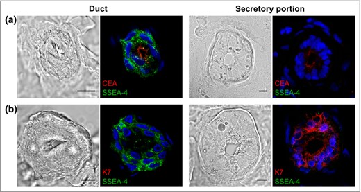 The expression of stage‐specific embryonic antigen‐4 (SSEA‐4) antigen in human sweat glands. (a) Confocal microscopy analysis of tissue cryosections stained with antibodies against SSEA‐4 (green) and carcinoembryonic antigen (CEA) (red) or (b) SSEA‐4 (green) and keratin 7 (K7) (red). Nuclei (blue) were counterstained with Hoechst 33258. Scale bars 10 μm.
