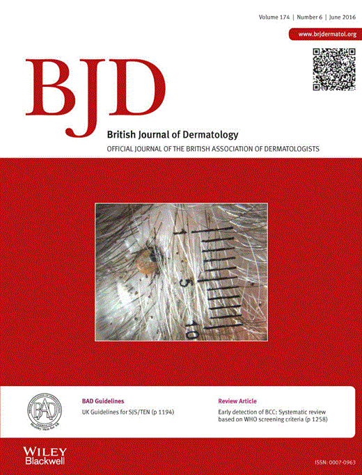 Atopic dermatitis (eczema) in US female nurses lifestyle risk factors