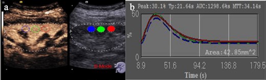 Quantitative analysis of CEUS. (a) CEUS image acquisition and frame selection of three ROI regions, which are in the renal cortex. (b) Contrast-enhanced ultrasound parameters in three regions of interest, including peak renal TP, PEAK, MTT, and the AUC. AUC, area under the curve; CEUS, contrast-enhanced ultrasound; MTT, mean transit time; PEAK, peak intensity; TP, parenchyma time.
