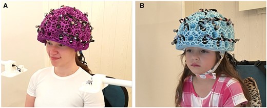 OPM-MEG system with (A) an adult helmet and (B) a child helmet.