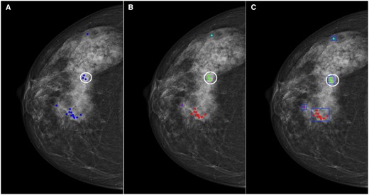 An illustration of a cancer case with all positive markings from one cohort. (A) The blue markings indicate the positive annotations with ratings above 2, and the white circle indicates the cancer border. (B) All positive markings were clustered, and each cluster was given a unique colour. (C) A rectangular box was drawn manually outside each cluster.