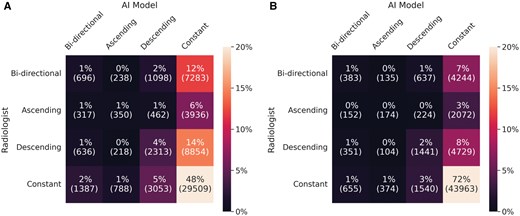 Confusion matrices for longitudinal patterns in (A) 4-category breast density and (B) binary breast density (dense vs. non-dense).