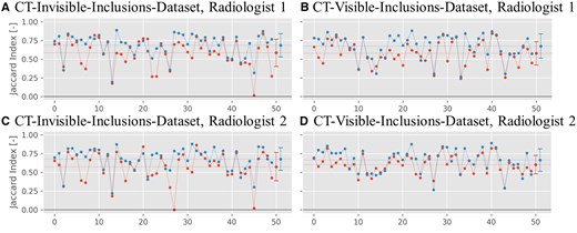 Jaccard index plots for the binary inclusion maps created by the 2 radiologists, when comparing to the ground truth. Red symbols indicate Jaccard indices for B-Mode images, and blue symbols indicate Jaccard indices for ML-augmented B-Mode images (as in Figure 5). The Jaccard indices are paired to be from the same phantom. Lines between points do not indicate interpolation but are rather meant to aid in comparing pairs of values. The horizontal dashed line indicates the mean of each set of Jaccard indices.