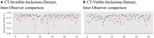 Jaccard index plots for the binary inclusion maps created by the 2 radiologists, when comparing with each other. Red symbols indicate Jaccard indices for B-Mode images, and blue symbols indicate Jaccard indices for ML-augmented B-Mode images (as in Figure 5). The Jaccard indices are paired to be from the same phantom. Lines between points do not indicate interpolation but are rather meant to aid in comparing pairs of values. The horizontal dashed line indicates the mean of each set of Jaccard indices.