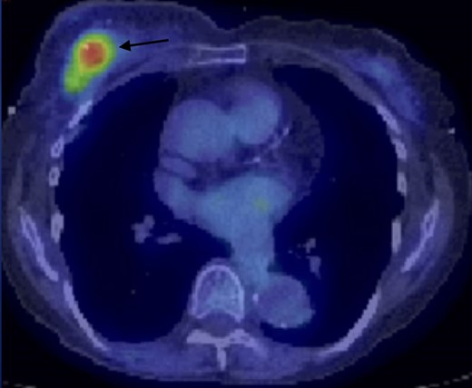 Figure 10.