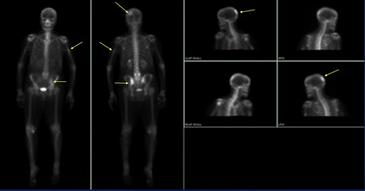 Figure 12.