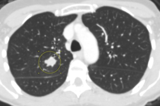 Figure 13.