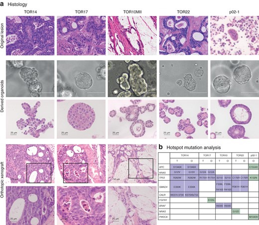 Morphological and molecular comparison of organoids of peritoneal metastases with parent tumours from which they were derived