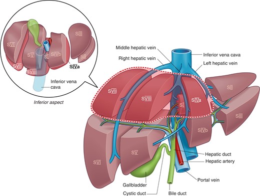 Illustration of posterosuperior liver segments
