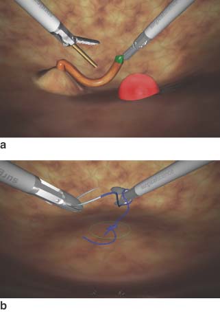 Sample tasks on the LapSim® laparoscopic trainer. a cutting; b suturing
