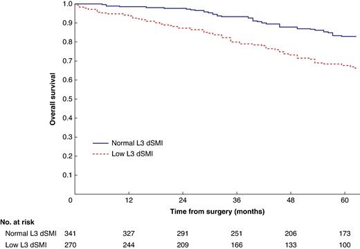 Overall survival in patients undergoing carotid endarterectomy for symptomatic carotid stenosis when subgrouped by L3 derived skeletal muscle index (P < 0.001)