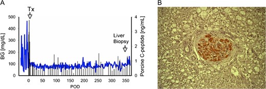 (A) Blood glucose and pig C-peptide levels in a streptozotocin-induced diabetic cynomolgus monkey before and after intraportal transplantation of islets from a pig expressing the human complement-regulatory protein, CD46. No exogenous insulin was administered after the transplant. The normoglycemic monkey was electively euthanized after 12 months. Tx = day of islet transplantation. (B) Insulin immunostaining (in red) of a liver section in a monkey recipient of islets from a pig transgenic for human CD46, showing a healthy pig islet 12 months after transplantation (magnification ×200).