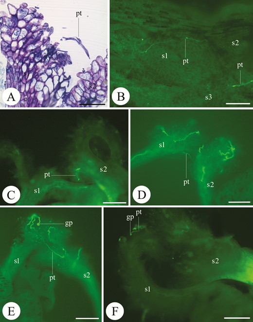 Stigma views (LM) of Ficus carautana (A), F. eximia (B), F. obtusifolia (C), F. pertusa (D, E) and F. roraimensis (F). Pollen tube growing from one stigma towards the adjacent one. Note the pollen grains germinating on the stigma (E, F). Symbols: s1, s2, s3 = stigma 1, 2 and 3, st = style, gp = germinating pollen grain, pt = pollen tube. Scale bars: A = 50 µm; B, C, E, F = 100 µm; D = 20 µm.