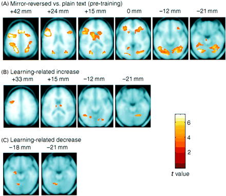 Projection of activiation maps from fixed-effects analysis for mirror-reading and learning-related changes on averaged anatomical slices.