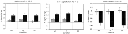 ROI analysis of spatial transformation effects. Open columns = session 1; stippled columns = session 2; inf = inferior. Error bars reflect within-subject standard error.