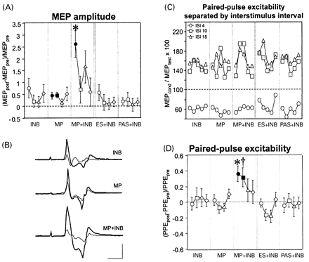 Changes in TMS-evoked motor cortical output to the biceps muscle as induced by different interventions. (A) MEP amplitude at the end of intervention (circles) and 20 min (squares), 40 min (triangles), and 60 min (diamonds) later are given as increments of the preintervention measurements (mean ± standard error). Filled symbols indicate significant differences from zero (P < 0.05). *Different from all other interventions at this time point (P < 0.05). (B) EMG recordings (averages of 10 trials) of the biceps MEP of one subject before (thin lines) and at the end of intervention (thick lines). Calibration bars, 15 ms (horizontal) and 0.25 mV (vertical). (C) Intervention-induced changes in paired-pulse excitability (PPE) shown separately for the three interstimulus intervals of 4 ms (circles), 10 ms (squares) and 15 ms (triangles). The five data points for each interval and intervention refer to the time points before intervention, late into intervention and 20, 40 and 60 min after the end of intervention. (D) Intervention-induced changes in PPE. †Different from all interventions except INB (P < 0.05). Other conventions as in panel A. INB = ischaemic nerve block at the forearm; MP = motor practice; MP+INB, ES+INB and PAS+INB = motor practice, electrical stimulation of the biceps muscle and passive elbow flexion movements, respectively, during INB.
