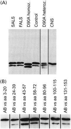 Immunoblotting of CSF. (A) CSF from one SALS, one FALS, one D90A homozyogous FALS, one D90A heterozygous ALS case and one control was immunoblotted with an antibody raised against amino acids 58–72 in the CuZn-SOD sequence. For comparison, a corresponding immunoblot from control CNS (lumbar anterior horn) is shown. (B) Immunoblots of control CSF using different rabbit antibodies raised against peptides corresponding to the indicated amino acid sequences in the CuZn-SOD subunit.