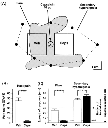 Secondary hyperalgesia to punctate mechanical stimuli persists in capsaicin-pretreated skin. (A) Arrangement for testing the effects of topical capsaicin pretreatment of the volar forearm (Caps = 10% capsaicin cream, 6 h each on two successive days; Veh = vehicle cream base) on secondary hyperalgesia elicited by intradermal capsaicin injection (40 μg in 12.5 μl). Following intradermal capsaicin injection (injection site marked by `x') into the strip of normal skin separating the pretreatment areas, a flare response (shaded area) developed that spread into the vehicle-pretreated area but not into the capsaicin-pretreated area (results from a typical subject). In contrast, secondary hyperalgesia developed symmetrically across both treatment areas (dotted line). (B) Inhibition of the afferent function of capsaicin-sensitive nociceptors was verified by almost complete abolition of heat-evoked pain (contact heat 53°C for 4 s, n = 10) in the capsaicin pretreatment area. (C) Inhibition of the efferent function of capsaicin-sensitive nociceptors was verified by almost complete abolition of capsaicin-evoked flare in the capsaicin pretreatment area. In contrast, secondary hyperalgesia to punctate stimuli developed symmetrically on either side (spatial extent of response along longitudinal axis of the forearm, n = 10).