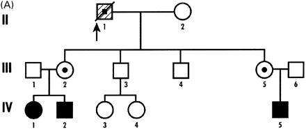 Fig. 1 Pedigree of (A) Case 1 and (B) Case 2.