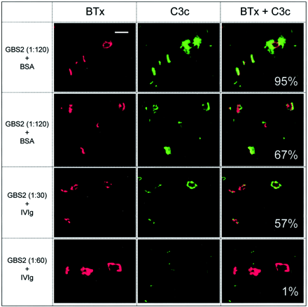 Fig. 5 Typical fluorescent confocal micrographs used for the quantitative analysis of complement load. Examples of pictures obtained in the series of studies titrating the effects of a Guillain–Barré syndrome serum (GBS2) dilution on the α‐latrotoxin‐like effect, in the presence of either bovine serum albumin (BSA; as a control) or intravenous immunoglobulin (IVIg) (Fig. 4). The α‐bungarotoxin signal (BTx), which was used to delineate the neuromuscular junction (NMJ), is shown in the first column, the complement signal (C3c) is shown in the second and the overlaid signals are shown in the third. The figure illustrates that, where present, the complement deposits are largely concentrated at the NMJ. In the third column, the percentage number represents the average complement load per area NMJ for all the end‐plates in the image shown. Scale bar = 50 µm.