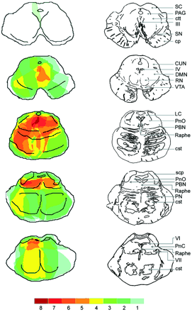 Fig. 5 The maximum area of lesion overlap in patients with coma and fatal hyperthermia. Once the MRI chartings were transferred to the template brainstem MRI atlas, the overlapping regions were coded with different colours. Dark red indicates the region where the lesion territories of eight patients overlapped. Note that the maximum overlap of lesion for patients with coma is in the core of the upper pontine tegmentum.