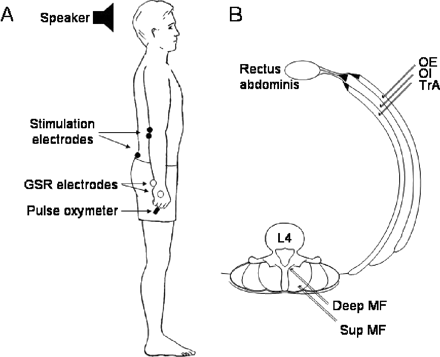 (A) Experimental set-up showing the site of electrodes for delivering the painful stimulation, recording the galvanic skin response (GSR) and recording EMG in anterior deltoid. Heart rate was recorded using a pulse oxymeter. (B) Intramuscular EMG electrodes inserted in the deep (Deep MF) and superficial (Sup MF) multifidus at the level of the lamina of the fourth lumbar vertebra. Intramuscular EMG electrodes also inserted through the anterolateral abdominal wall, ∼3 cm caudal to the inferior border of the ribs in obliquus externus (OE) and obliquus internus (OI) and transversus abdominis (TrA).