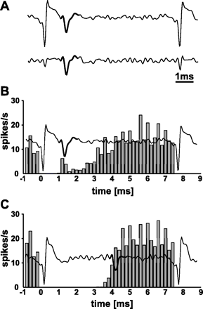 Stimulation artefact and STN neuronal activity while performing STN-HFS. (A) Example of representative filtered analogue recordings before (above) and after subtraction of the stimulation artefact (below). (B, C) Two representative filtered analogue recordings, each showing the stimulation artefact and a representative spike (bold) that was recognized by Alpha Omega's Multi Spike Detector. The filtered analogue signal of each example is superimposed to a peristimulus histogram of the respective STN neuron that is aligned to the onset of the stimulation artefact (t = 0 ms) in 0.2 ms bins. The spike count of each bin is normalized by the total number of electrical stimuli and the bin size. Note that the analogue signal shows only one representative spike between two stimulation artefacts, while the peristimulus histogram represents the firing probability over the entire 6 min of HFS. (B) The close relation of the spike to the stimulation artefact underlines that the template-matching algorithm reliably recognized spikes during STN-HFS except for the period of complete saturation. (C) Most STN neurons (29/43) resumed their neuronal activity over 3 ms after the onset of the electrical stimulus, i.e. long after the end of complete saturation of the recording signal.