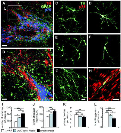 Co-localization of dopamine neurons and OEC in vivo, and morphology and quantification of cell survival and neurite growth in vitro. Panels (A) and (B) show a section from an OEC/VM co-graft, triple-labelled for TH, GFAP and p75. The boxed area in (A) is enlarged in (B). TH+ fibres were observed within the graft and growing into host striatum [arrow in (A)]. Close contact between TH+ cell bodies and fibres and p75+ OEC were observed within the graft (B). TH+ neurons in control cultures (C) and (D) had a more branched morphology compared to neurons cultured in OEC conditioned medium (E) and (F) or in direct contact with OEC (G) and (H). Dopamine neurons cultured in direct contact with the OEC monolayer had a more elongated bipolar morphology (G) and were often seen growing aligned to p75+ OEC (H). Culturing fetal VM cells in direct contact with OEC or in OEC-conditioned medium increased survival of TH+ neurons significantly compared to control cultures (I). Both direct contact with OEC and conditioned medium also enhanced the length of the longest neurite significantly compared to control (J). TH+ neurons cultured in direct contact with OEC had significantly fewer primary neurites and branching points compared to neurons in control and conditioned medium cultures (K) and (L). OEC-conditioned medium appeared to be intermediate between direct contact and control with respect to cell survival, neurite length and branching points (I)–(L). Scale bars: (A) 100 μm, (B) 20 μm, (C), (E) and (G) 50 μm, (D), (F) and (H) 50 μm. Error bars ± SEM, *P < 0.05, **P < 0.01, ***P < 0.005.
