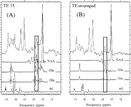 Comparison of glutamate detection with conventional PRESS and TE-averaged PRESS at 3 T in an in vivo spectrum. In a conventional 3 T PRESS spectrum at TE 35 ms (A), glutamate at 2.35 p.p.m. overlaps with the N-acetyl group of NAA (2.02 p.p.m.) and glutamine signals, making it difficult to isolate the glutamate resonance. In comparison, TE-averaged PRESS (B) fully resolves the glutamate at 2.35 p.p.m. from overlap from NAA and glutamine, resulting in its unobstructed detection. In this figure each trace represents a TE-averaged spectrum of the given metabolite, i.e. NAA, glutamate, glutamine and myo-inositol, obtained from phantoms that only contained each respective metabolite.