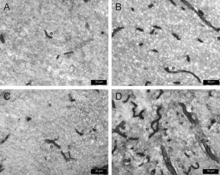 P-glycoprotein (Pgp) expression in representative transverse sections of rat brain, using 3,3′-diaminobenzidine as chromogen and the monoclonal antibody C219 for Pgp immunostaining. Prominent immunoreactivity is evident in endothelial cells of capillaries (e). A and B are sections from the dentate gyrus; C and D are sections from the piriform cortex. Sections are from the ipsilateral hemisphere 3.8 mm posterior to bregma (Paxinos and Watson, 1998). The sections shown in A and C are from phenobarbital responders (DS104 and DS115, respectively); sections in B and D are from a non-responder (DS118), illustrating the striking increase in the number of capillaries expressing Pgp in non-responders.
