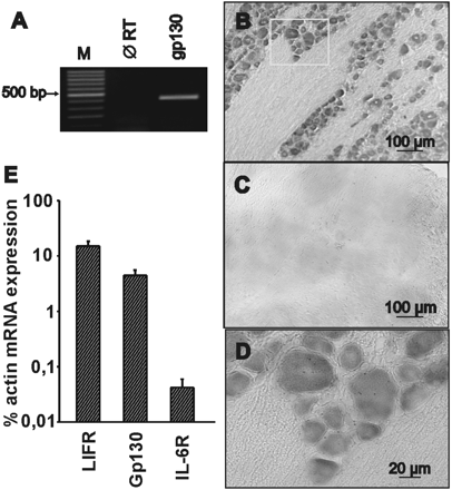 The signal transducer molecule gp130 is expressed in rat DRGs. (A) RT–PCR reveals the expression of gp130 mRNA in rat DRGs (M, marker; ∅ RT, without reverse transcriptase). (B and D) In situ hybridization with gp130-specific antisense probes shows the neuronal expression of gp130 mRNA in rat DRG sections. (C) Negative control with sense probes. (E) Relative expression of IL-6R, LIFR and gp130 mRNA in rat DRG samples. Preparations of mRNA from rat DRG were analysed for the expression level of IL6R, LIFR, gp130 and β-actin mRNA using TaqMan RT–PCR. For each gene, PCRs were carried out with serial dilutions of cDNA. The mean expression levels (±SD) of IL-6R, LIFR and gp130 mRNA in DRG of three different animals were calculated as the percentage of actin mRNA expression.