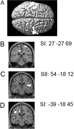 Activations due to tactile stimulation in the non-synesthetic group. (A) Somatosensory activations resulting from the comparison of the four touch conditions relative to rest baseline superimposed on a surface-rendered MR image. (B) SI activation resulting from the comparison of the two touch–face conditions relative to the two touch–neck conditions on a coronal section of a T1 image at y = −27. (C) Right SII activation resulting from the comparison of the two touch–left side conditions relative to the two touch–right side conditions on a coronal section of a T1 image at y = −18. (D) Left SI and SII activation resulting from the comparison of the two touch–right side conditions relative to the two touch–left side conditions shown on a coronal section of a T1 image at y = −18.