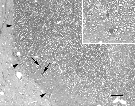 Light micrograph showing a portion of the left dorsal funiculus (margin delineated by arrowheads), and adjacent grey matter, at the approximate site of an injection of saline 7 days earlier. A very small number of axons undergoing Wallerian degeneration are present (arrows; shown at higher magnification in the inset), probably resulting from the insertion of the injection pipette. The tissue otherwise is apparently normal. Scale bars: main image, 50 µm; inset, 20 µm.